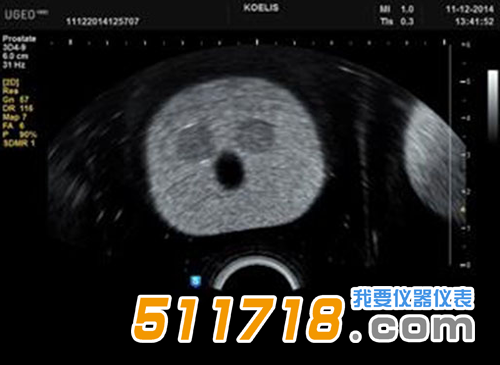 美國(guó)CIRS 053S 053L 053L-EF前列腺M(fèi)RI測(cè)試體模3.png